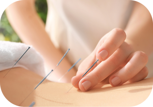 Acupuncture NW Calgary 