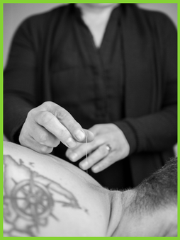 Acupuncture Packages Calgary